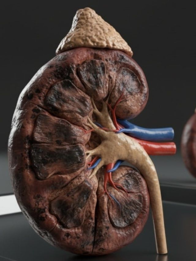 अंदर ही अंदर 'किडनी को खाना' शुरू कर देते हैं ये 4 फूड्स! आज ही बना लें इनसे दूरी