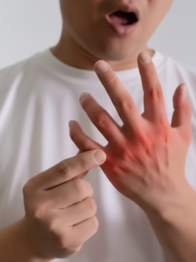 स्किन पर भी दिखते हैं हाई यूरिक एसिड के खतरनाक संकेत, समय रहते करें पहचान