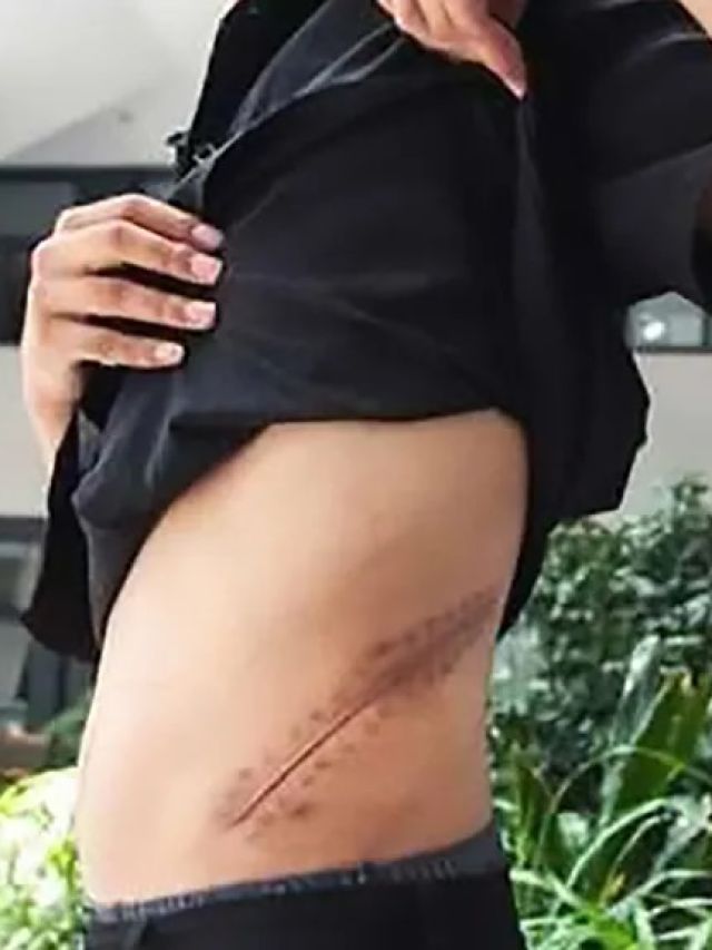 The teen who sold his kidney for an iPhone—and lost his life to it